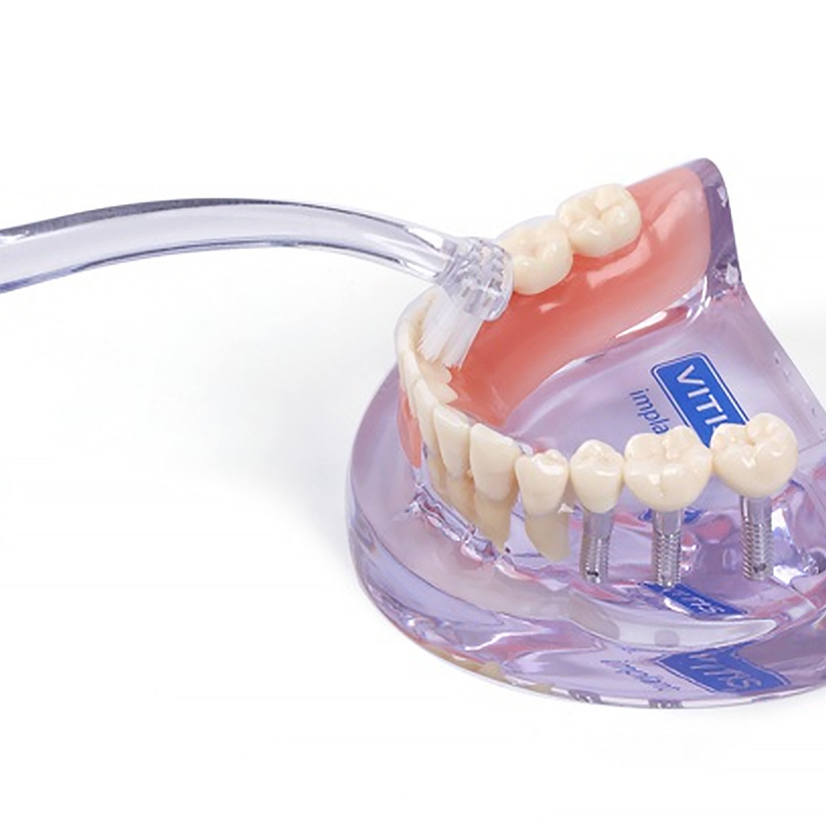 Vitis Implant Angular tandenborstel