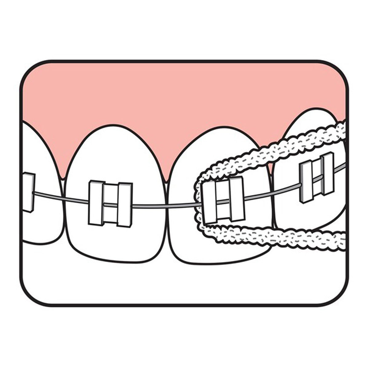 TePe Bridge & Implant floss