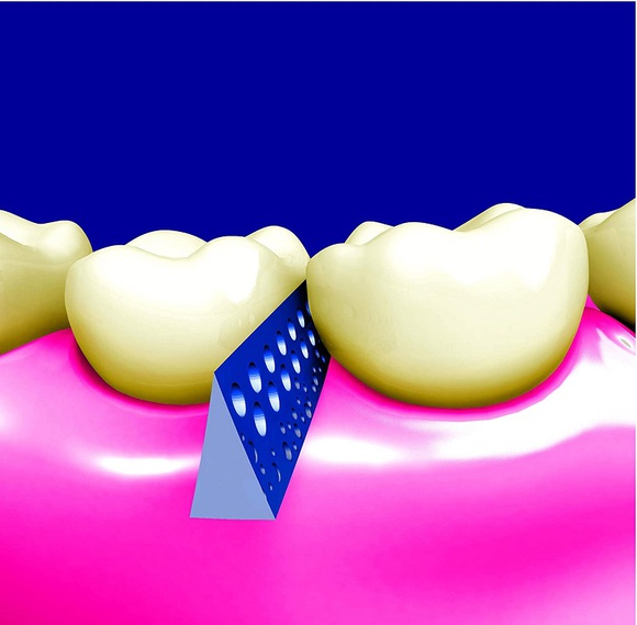 pikstix plastic tandenstokers met micro holes
